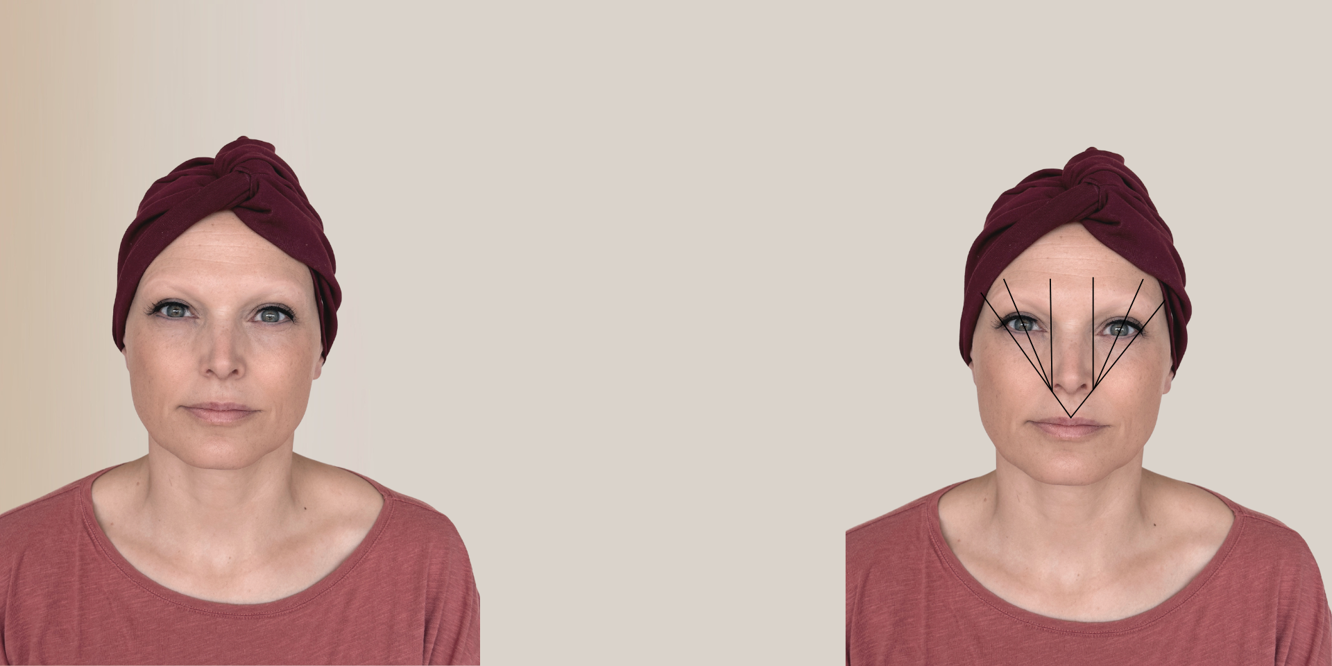 Vorher Augenbrauen Kleben