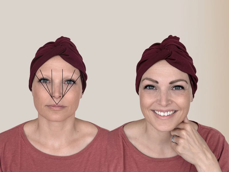 VorherNachherKleben der Augenbrauen